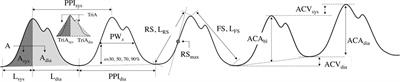 Postoperative Pain Assessment Indices Based on Photoplethysmography Waveform Analysis